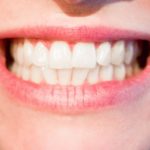 Zdrowe zęby – sposób na przepiękny uśmiech